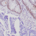 Anti-PMS-2 antibody [ZR317] (STJ180591) – Figure 1 of 1