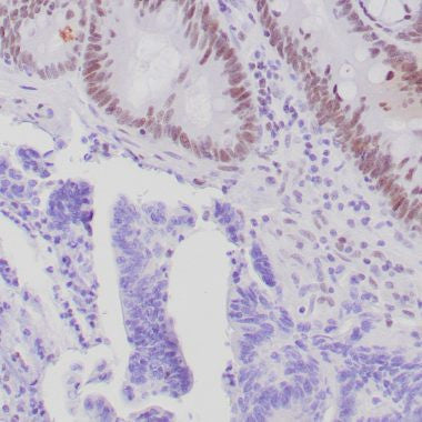 Anti-PMS-2 antibody [ZR317] (STJ180591) – Figure 1 of 1