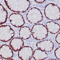 Anti-SATB2 antibody (150-350aa) [ZR167] (STJ180539) – Figure 1 of 1