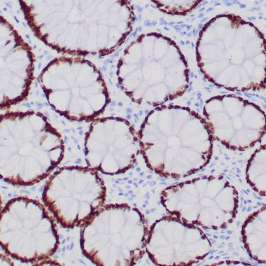 Anti-SATB2 antibody (150-350aa) [ZR167] (STJ180539) – Figure 1 of 1