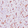 Anti-SOX-9 antibody (393-508aa) [ZM171] (STJ180371) – Figure 1 of 1