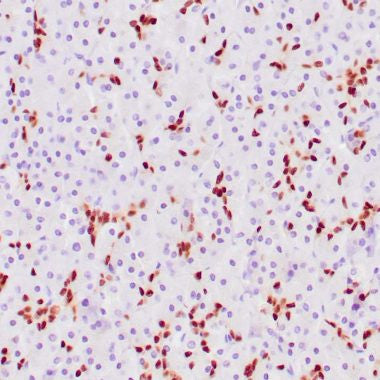 Anti-SOX-9 antibody (393-508aa) [ZM171] (STJ180371) – Figure 1 of 1