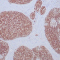 Anti-SF-1 antibody (200-400aa) [ZR397] (STJ180598) – Figure 1 of 1