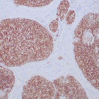 Anti-SF-1 antibody (200-400aa) [ZR397] (STJ180598) – Figure 1 of 1