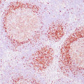 Anti-TCL-1 antibody (2-109aa) [ZM92] (STJ180328) – Figure 1 of 1