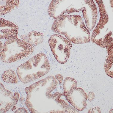 Anti-TROP2 antibody (31-274aa) [ZR388] (STJ180599) – Figure 1 of 1