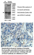 Anti-ANXA13 Antibody – Figure 1 of 1