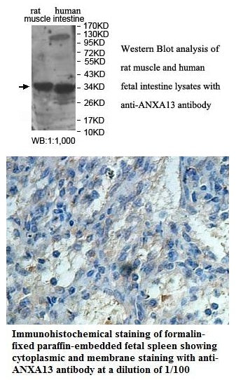 Anti-ANXA13 Antibody – Figure 1 of 1