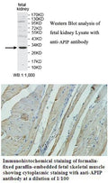 Anti-APIP Antibody – Figure 1 of 1