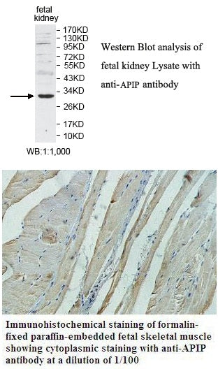 Anti-APIP Antibody – Figure 1 of 1