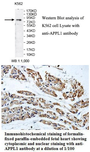 Anti-APPL1 Antibody – Figure 1 of 1