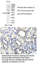 Anti-APTX Antibody – Figure 1 of 1