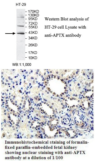 Anti-APTX Antibody – Figure 1 of 1