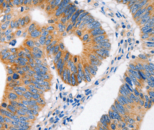 MC1R Polyclonal Antibody – Figure 1 of 3