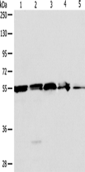 NAMPT Polyclonal Antibody – Figure 1 of 4