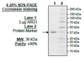 ARG1, His-Tag Recombinant – Figure 1 of 2