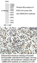 Anti-ARHGAP15 Antibody – Figure 1 of 1