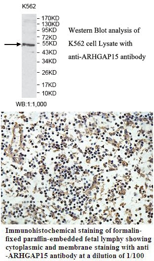 Anti-ARHGAP15 Antibody – Figure 1 of 1