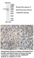 Anti-ARHGEF9 Antibody – Figure 1 of 1