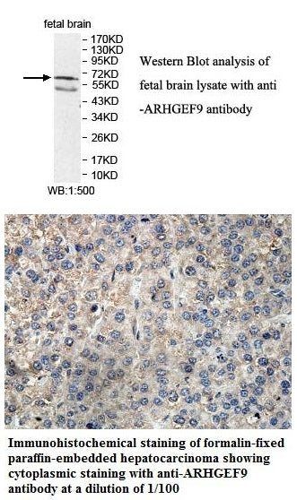 Anti-ARHGEF9 Antibody – Figure 1 of 1
