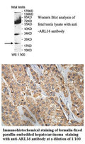 Anti-ARL16 Antibody – Figure 1 of 1