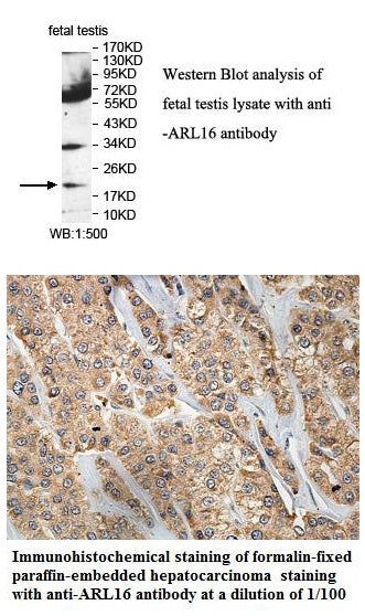 Anti-ARL16 Antibody – Figure 1 of 1