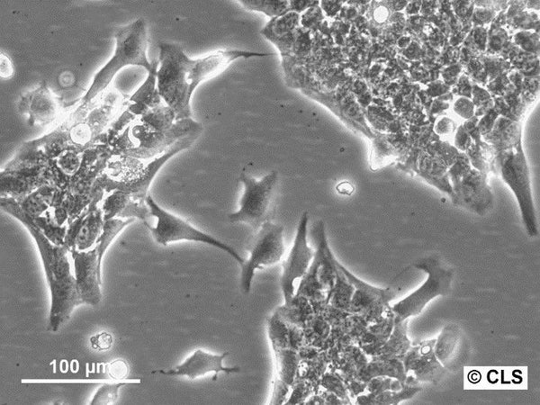 ASB-XIV cell