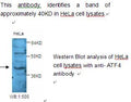 Anti-ATF4 Antibody – Figure 1 of 1