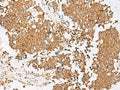 GSTM2 Polyclonal Antibody – Figure 1 of 3