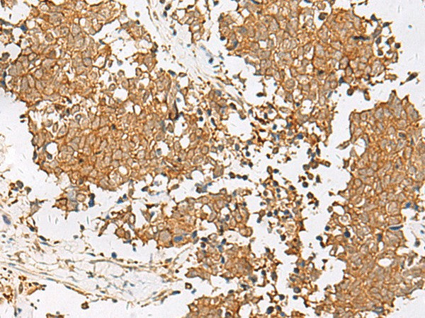 GSTM2 Polyclonal Antibody – Figure 1 of 3