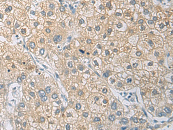 IL1RN Polyclonal Antibody – Figure 1 of 2