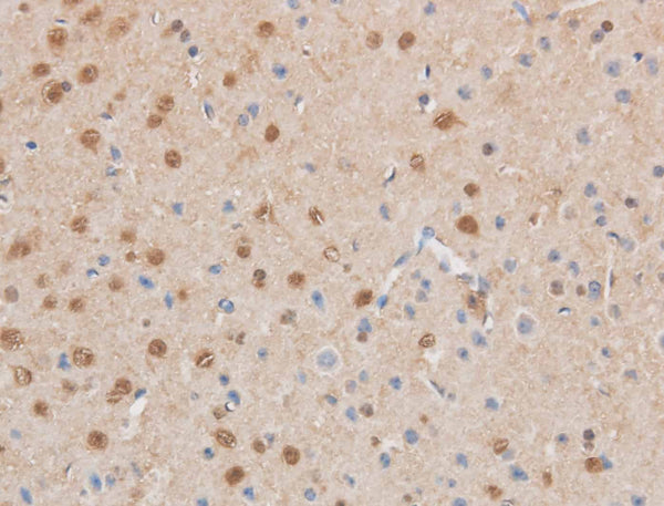 MAP2K6 Polyclonal Antibody – Figure 1 of 3