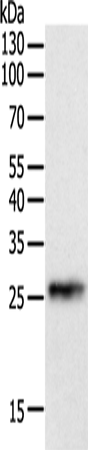 CRP Polyclonal Antibody – Figure 1 of 3