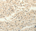 FZD8 Polyclonal Antibody – Figure 1 of 3