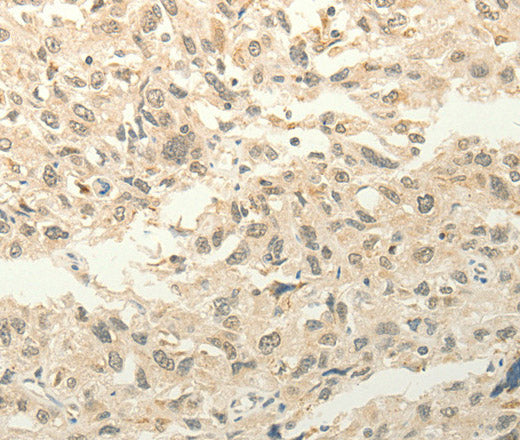 FZD8 Polyclonal Antibody – Figure 1 of 3