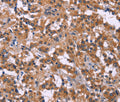PIP5K1B Polyclonal Antibody – Figure 1 of 3