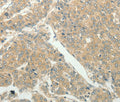 SLC8A3 Polyclonal Antibody – Figure 1 of 2