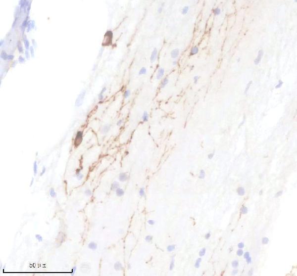 Anti-Zebrafish TPH2 Antibody