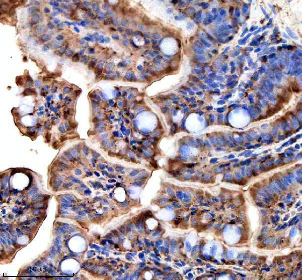 Anti-Zebrafish TTC7B Antibody