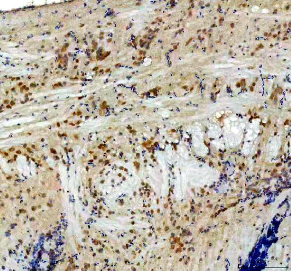 Anti-Zebrafish CYP11C1 Antibody