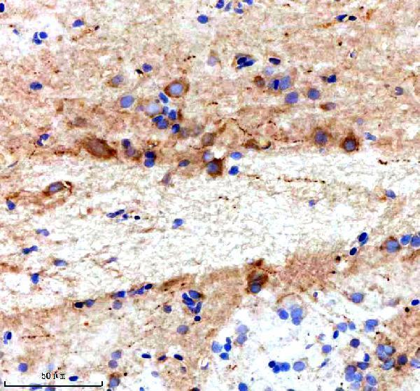 Anti-Zebrafish TTC28 Antibody