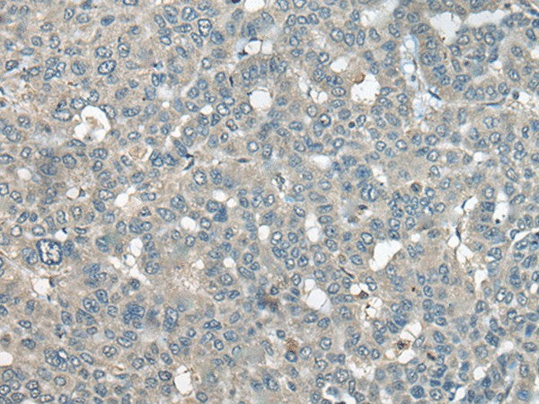 UCN3 Polyclonal Antibody – Figure 1 of 3