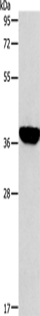 ALDOB Polyclonal Antibody – Figure 1 of 4