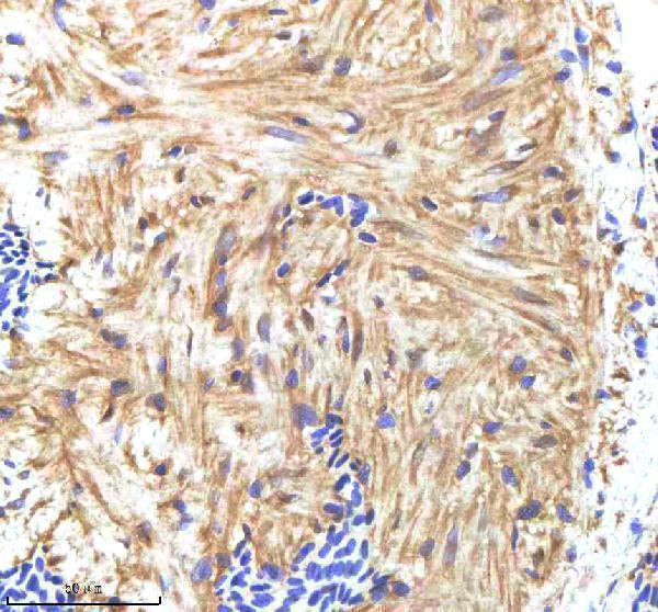 Anti-Zebrafish HAND2 Antibody