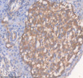 Anti-Zebrafish ACOX1 Antibody