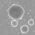 B-LCL-CDG2 cell