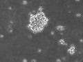 B-LCL-HROC10 cell