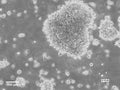 B-LCL-HROC102 cell