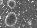 B-LCL-HROC103 cell