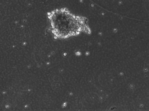 B-LCL-HROC117 (Bc HROC117) cell